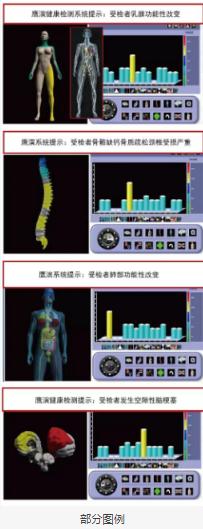 高端健康体检**法国鹰演，检测10分钟，疾病风险早知道-鹰演医学-www.yingyanyixue.com